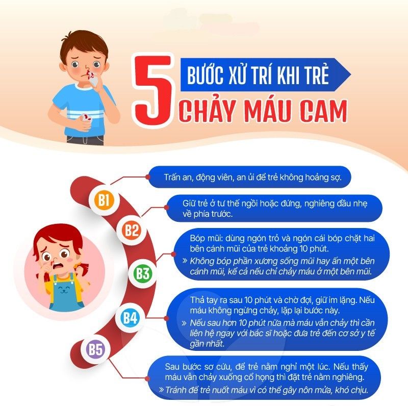5 bước xử trí khi học sinh chảy máu cam