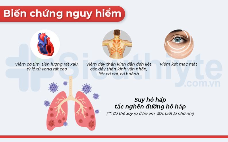 Biến chứng nguy hiểm của bệnh bạch hầu