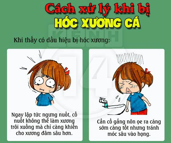 Phòng tránh hóc xương cá