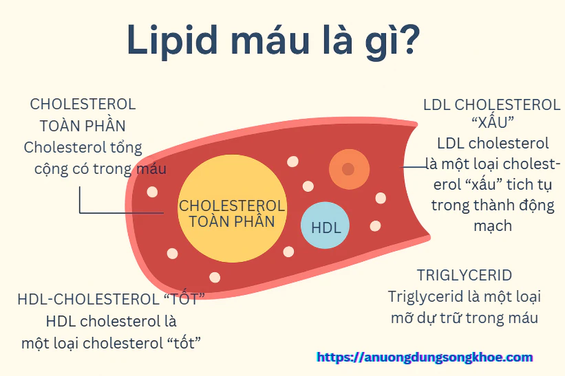 Infographic giải thích lipid máu là gì và các thành phần chính như cholesterol, LDL, HDL, triglycerid trong máu