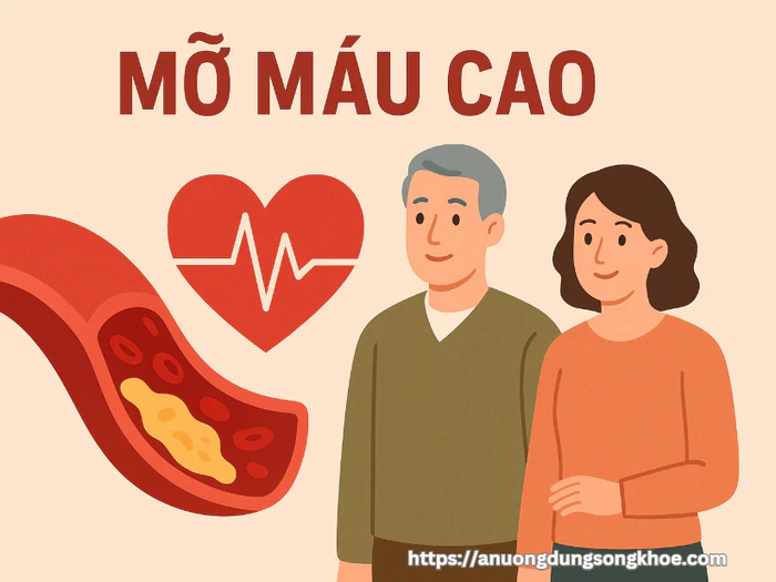 Hình minh họa mỡ máu cao và cholesterol tích tụ trong thành mạch máu
