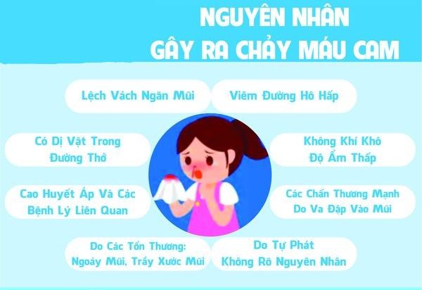 Nguyên nhân chảy máu cam