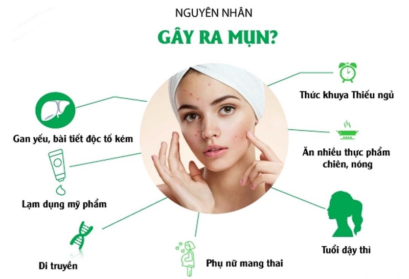 nguyên nhân gây mụn và cách trị tận gốc