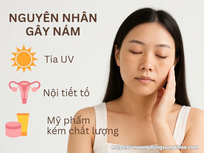 Phân Biệt Nám và Tàn Nhang: Nguyên Nhân, Cách Nhận Biết & Điều Trị Hiệu Quả