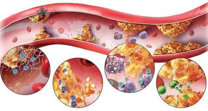Tác hại của chất béo xấu với sức khỏe tim mạch & chuyển hóa
